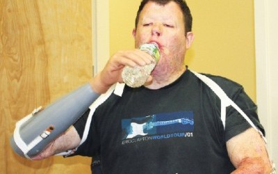 Albertson biz gives new life to injured client Albertson biz gives new life to injured client