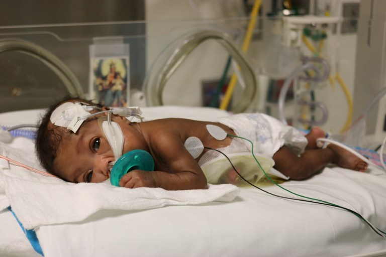 NYU Winthrop’s advances with preterm infant feeding problems expected to prompt paradigm shift in nationwide protocol NYU Winthrop’s advances with preterm infant feeding problems expected to prompt paradigm shift in nationwide protocol