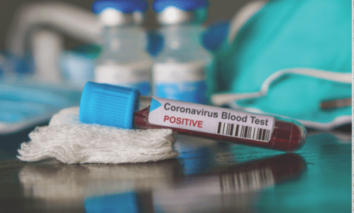 General information on the coronavirus vaccine
