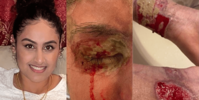 Family of acid attack victim, Sewanhaka graduate, criticizes police’s handling of investigation Family of acid attack victim, Sewanhaka graduate, criticizes police’s handling of investigation
