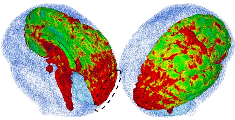 Research from New York Institute of Technology College of Osteopathic Medicine could change assumptions about helmet safety